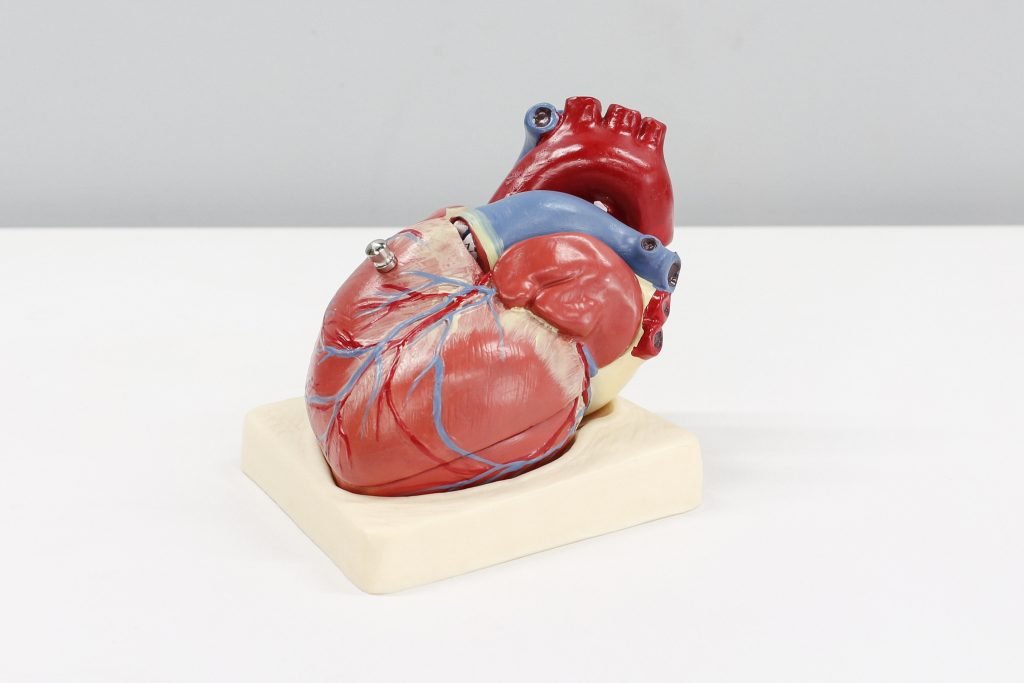 Apa Itu Acute Inferior Myocardial Infarction?