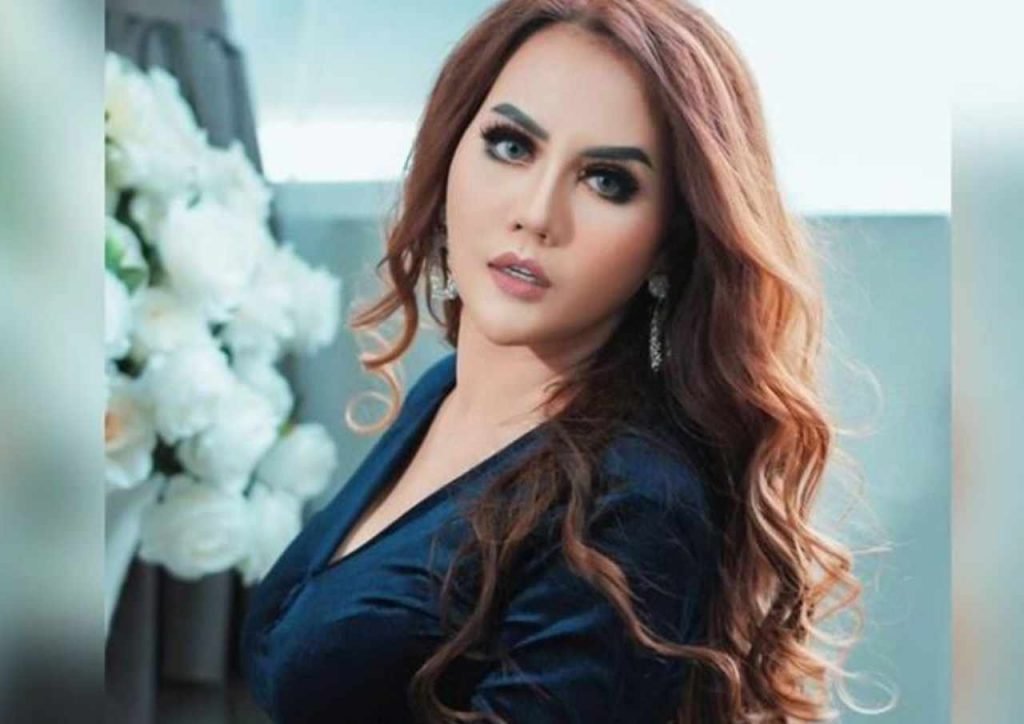 Pedangdut Nita Talia Kena Penyakit Saraf Otak
