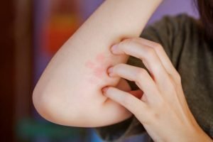 Kebiasaan yang Bisa Timbulkan Masalah Kulit/iStock