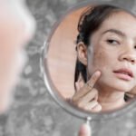 Hati-hati, Hindari Hal yang Jadi Penyebab Flek Hitam di Wajah Berikut Ini