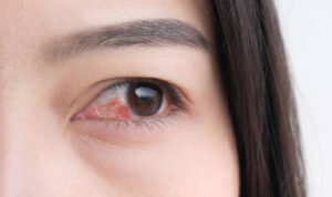 istockphoto 1130625414 612x612 1 - Lifestyle