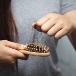 Cara Atasi Rambut Rontok
