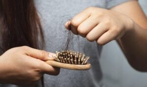 Cara Atasi Rambut Rontok