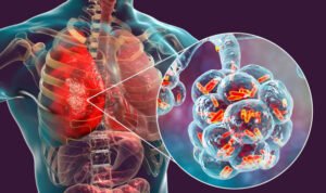 istockphoto 1028375682 612x612 1 - Rembang