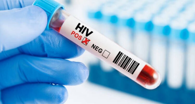 Ilustrasi kasus HIV/istock