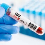 Human immunodeficiency virus blood test in hand istockphoto 2164351231 612x612 2 - Penularan HIV