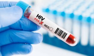 Human immunodeficiency virus blood test in hand istockphoto 2164351231 612x612 2 - Rembang